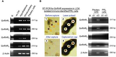 Differential involvement of cAMP/PKA-, PLC/PKC- and Ca2+/calmodulin-dependent pathways in GnRH-induced prolactin secretion and gene expression in grass carp pituitary cells